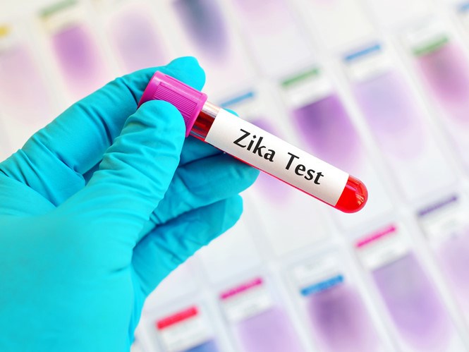 5 tỉnh thành ghi nhận bệnh nhân nhiễm vi rút Zika