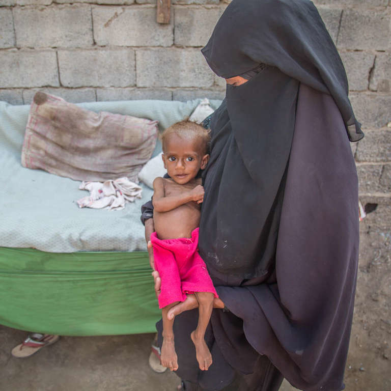 Một bà mẹ người Yemen đang bế đứa con nhỏ bị bệnh nhưng không có tiền để đưa đi bệnh viện - Ảnh: 