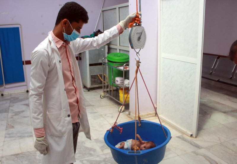 Suy dinh dưỡng trẻ em là vấn đề nghiêm trọng nhất đối với Yemen trong suốt thời gian vừa qua - Ảnh: 
