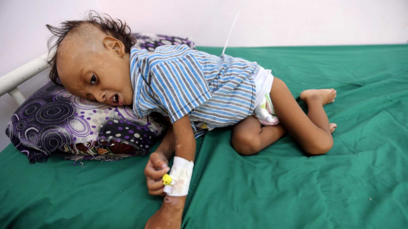 Hầu như toàn bộ hệ thống y tế địa phương của Yemen đều bị ngưng hoạt động khiến nhiều trẻ em không thể tiếp cận các dịch vụ y tế cơ bản - Ảnh: 