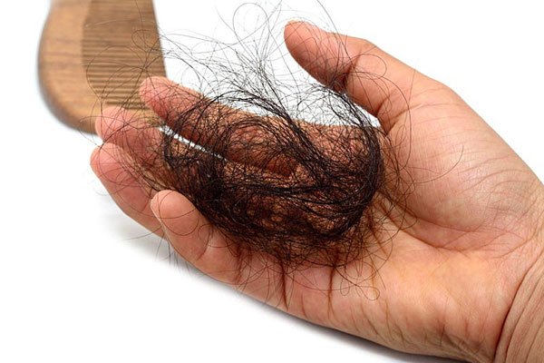 Nhà khoa học Nhật đã cố gắng tìm ra phương pháp phục hồi tóc từ các tế bào gốc.